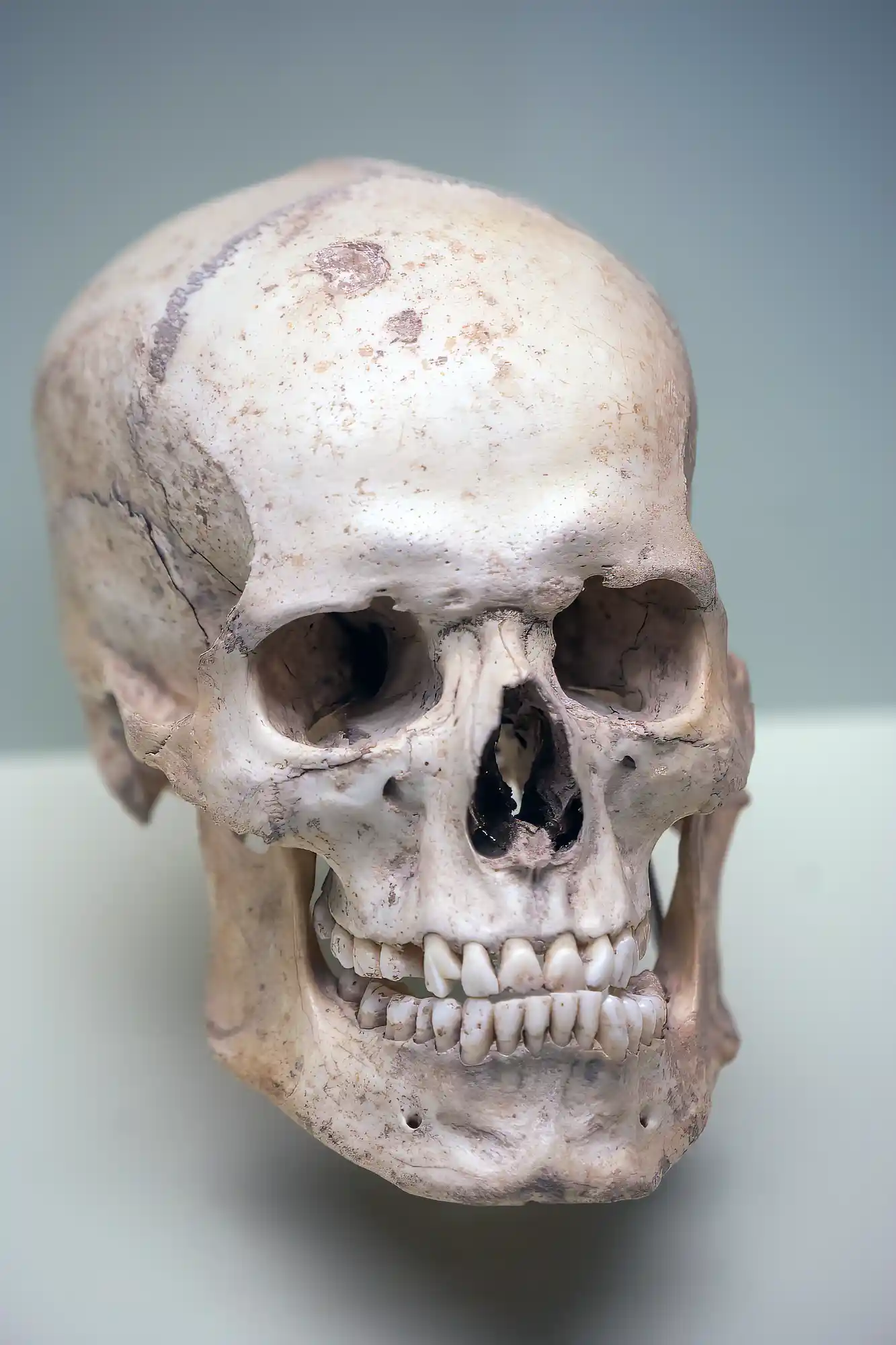 Teruel skull