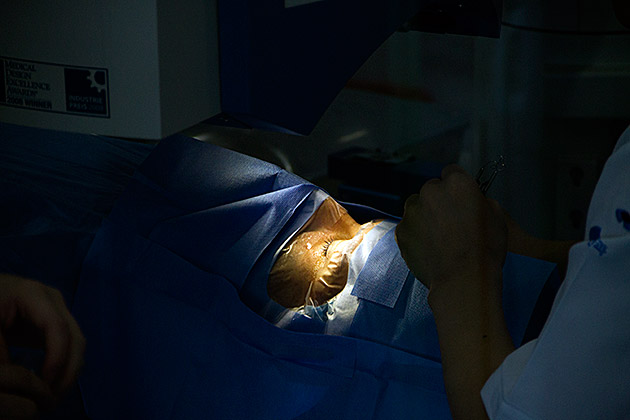 Lasik Surgery